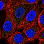 Anti-SLC25A51 Antibody