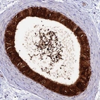 Anti-DEFB132 Antibody