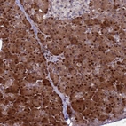 Anti-WBP11 Antibody