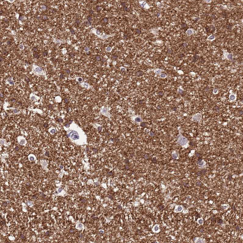 Anti-NLRP11 Antibody