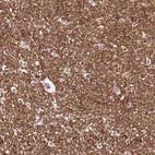 Anti-NLRP11 Antibody