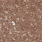 Anti-NLRP11 Antibody
