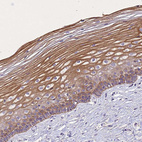 Immunohistochemical staining of human cervix, uterine shows strong cytoplasmic positivity in squamous epithelial cells.