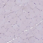 Immunohistochemical staining of human skeletal muscle shows no positivity in myocytes as expected.