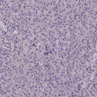 Immunohistochemical staining of human pancreas shows no positivity in exocrine glandular cells as expected.