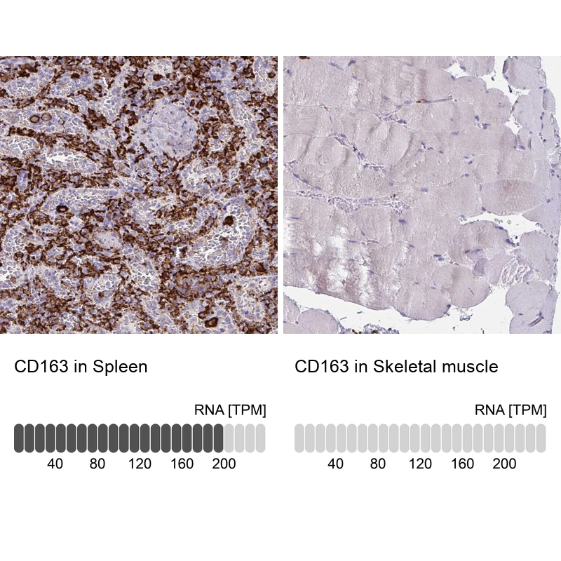 Rabbit Polyclonal Anti-CD163 Antibody - Buy for research - Highly ...