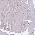 Immunohistochemical staining of human skeletal muscle shows low positivity as expected.