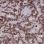 Immunohistochemical staining of human spleen shows strong membranous positivity in cells in red pulp.