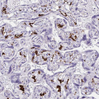 Anti-CD163 Antibody