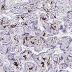 Immunohistochemical staining of human placenta shows strong membranous positivity in lymphoid cells.