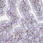 Immunohistochemical staining of human duodenum shows strong membranous positivity in lymphoid cells.