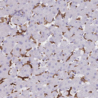 Anti-CD163 Antibody