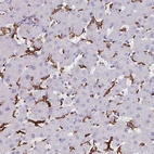 Immunohistochemical staining of human liver shows strong membranous positivity in Kupffer cells.