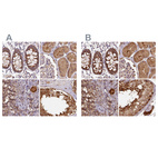 Anti-ST13 Antibody