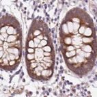 Anti-ST13 Antibody