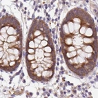 Immunohistochemical staining of human colon using Anti-ST13 antibody HPA046412.