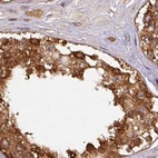 Immunohistochemical staining of human testis using Anti-ST13 antibody HPA046412.
