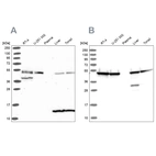 Western blot analysis using Anti-ST13 antibody HPA046412 (A) shows similar pattern to independent antibody HPA047114 (B).