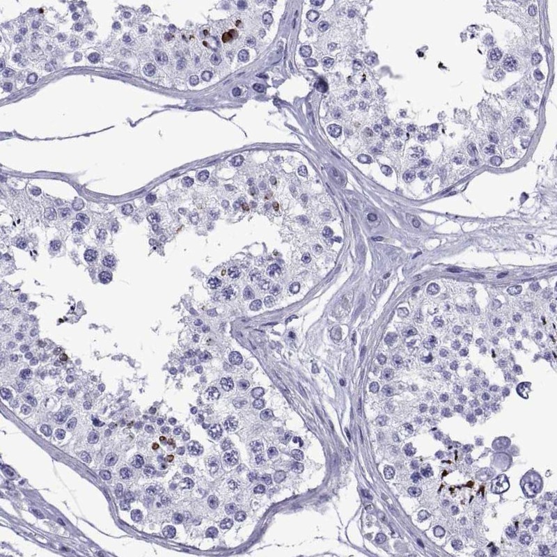 Anti-SPANXC Antibody