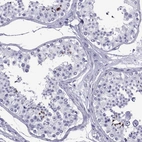 Anti-SPANXC Antibody