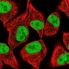 Immunofluorescent staining of human cell line A549 shows localization to nucleoplasm.