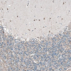 Immunohistochemical staining of human cerebellum shows weak to moderate cytoplasmic positivity in cells in molecular layer.