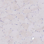 Anti-OCM Antibody