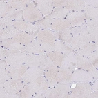 Immunohistochemical staining of human skeletal muscle shows no positivity in myocytes as expected.