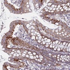 Anti-C3orf36 Antibody