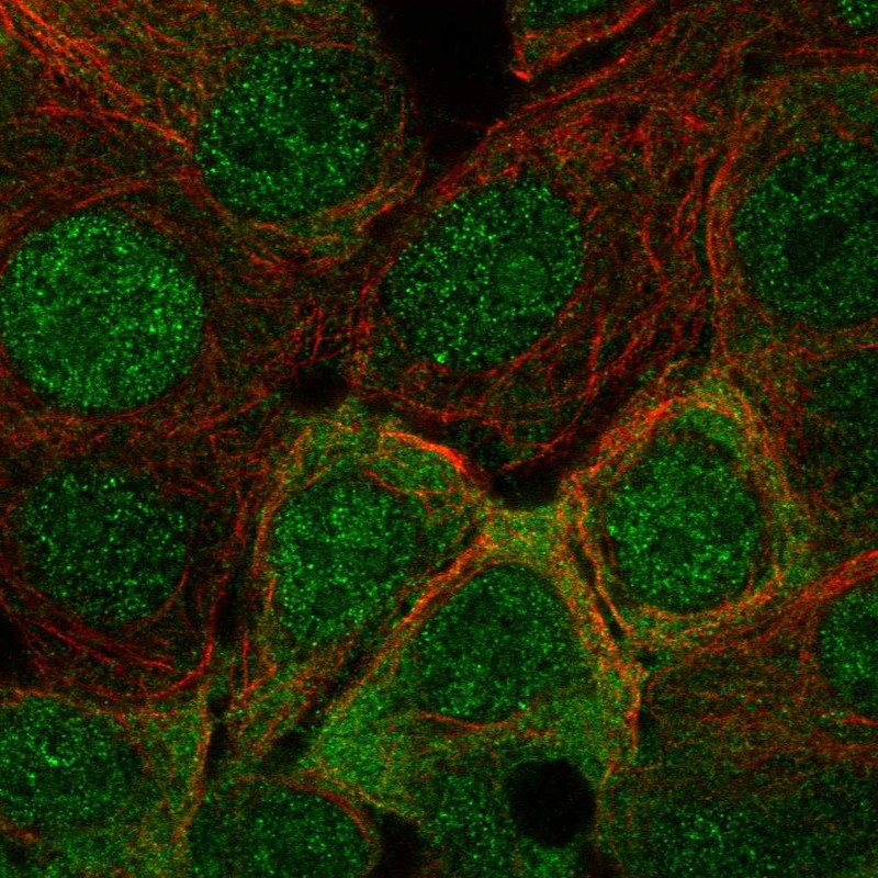Anti-IRS1 Antibody