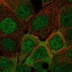 Anti-IRS1 Antibody