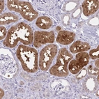 Anti-GLRX Antibody