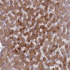 Anti-ORM1 Antibody