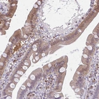 Immunohistochemical staining of human duodenum shows moderate cytoplasmic positivity in glandular cells.