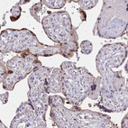 Anti-GLRX Antibody