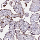 Immunohistochemical staining of human placenta shows moderate cytoplasmic positivity in trophoblastic cells.