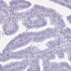 Immunohistochemical staining of human fallopian tube shows no positivity in glandular cells as expected.