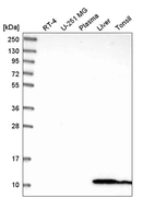 Western blot analysis in human cell line RT-4, human cell line U-251 MG, human plasma, human liver tissue and human tonsil tissue.