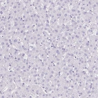 Immunohistochemical staining of human liver shows no positivity in hepatocytes as expected.