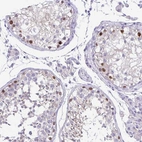 Immunohistochemical staining of human testis shows moderate nuclear positivity in cells in seminiferous ducts.