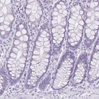 Immunohistochemical staining of human colon shows no positivity in glandular cells as expected.