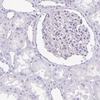 Immunohistochemical staining of human kidney shows no positivity in cells in tubules as expected.