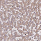 Anti-DPH5 Antibody