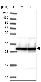 Lane 1: Marker [kDa] 250, 130, 95, 72, 55, 36, 28, 17, 10_br/_Lane 2: Human cell line RT-4_br/_Lane 3: Human cell line U-251MG sp
