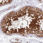 Anti-RPAP2 Antibody