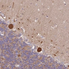 Immunohistochemical staining of human Cerebellum shows strong nuclear and cytoplasmic positivity in Purkinje cells.