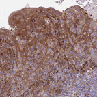 Anti-RPAP2 Antibody