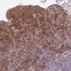 Immunohistochemical staining of human Tonsil shows moderate nuclear and cytoplasmic positivity in squamous epithelial cells.