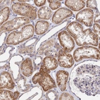 Immunohistochemical staining of human Kidney shows moderate cytoplasmic positivity in cells in tubules.