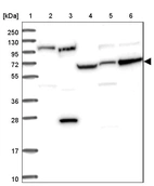 Lane 1: Marker [kDa] 250, 130, 95, 72, 55, 36, 28, 17, 10_br/_Lane 2: Human cell line RT-4_br/_Lane 3: Human cell line U-251MG sp_br/_Lane 4: Human plasma (IgG/HSA depleted)_br/_Lane 5: Human liver tissue_br/_Lane 6: Human tonsil tissue